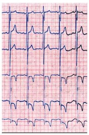 kardiografi-jantung-alat